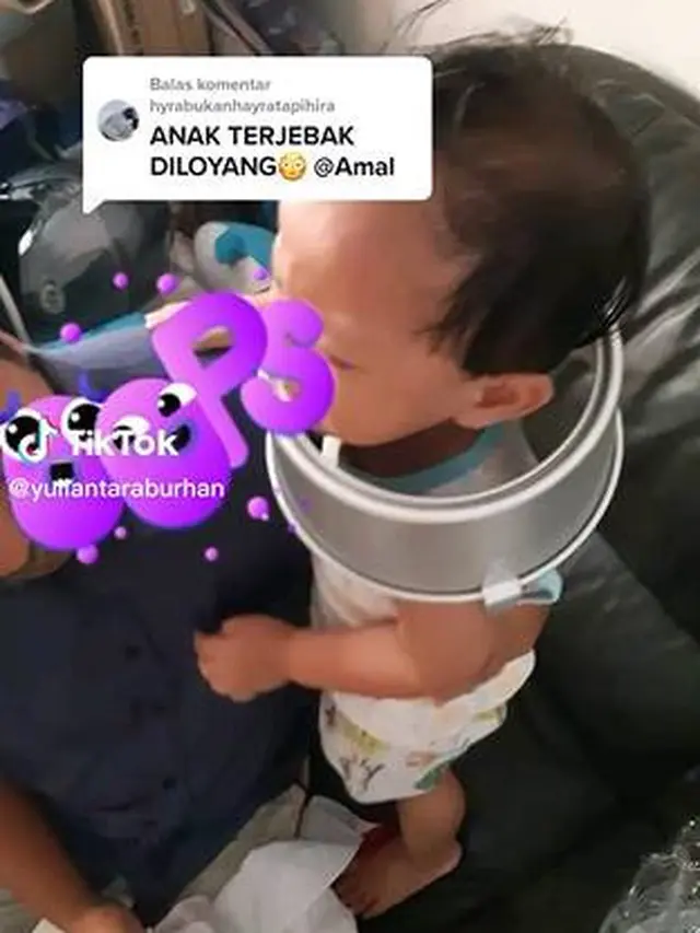 Viral, Kepala Anak Ini Nyangkut di Loyang Kue, Diselamatkan Damkar