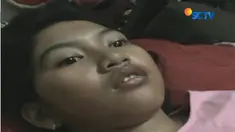 Dokter kejiwaan yang sempat memeriksa Echa menyatakan, gadis ini menderita penyakit hypersomnia atau kelebihan tidur.