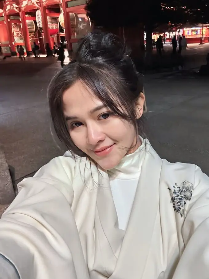 Wajah Sehat dan Glowing Bella Bonita Terungkap saat Liburan ke Jepang