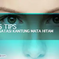 5 Tips Mengatasi Kantung Mata Hitam