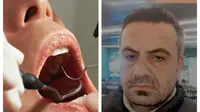 Gigi pria ini dicabut oleh petugas kebersihan yang menyamar jadi dokter, alami sakit selama sebulan. Sumber: Odditycentral