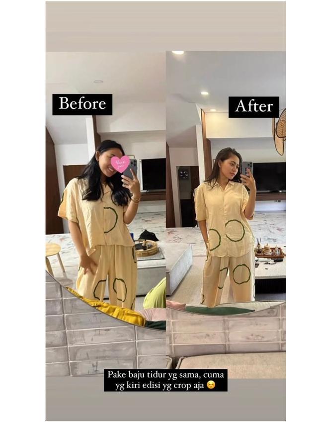 Berat Badan Turun 10 Kg, Ini 6 Potret Rachel Vennya yang Kembali Aktif Media Sosial