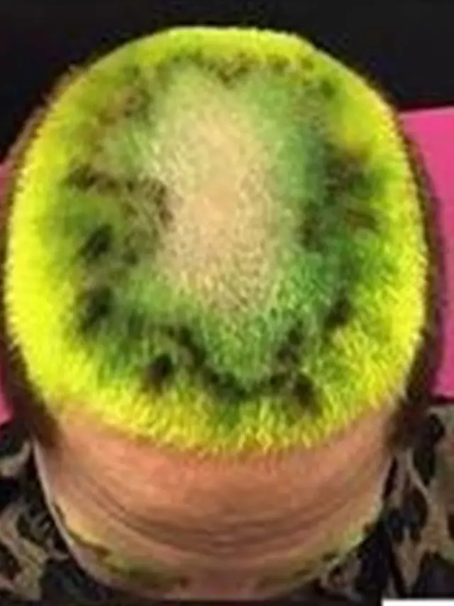 6 Potongan Rambut Model Buah-Buahan Ini Absurd Banget, Kocak