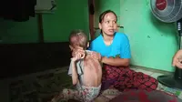 Maiyah dan putri sulungnya yang lumpuh sejak berusia 4 bulan. DIa mengaku belum mendapat bantuan selama pandemi Corona ini. (Liputan6.com/Yandhi Deslatama)