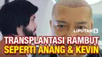 Anang Hermansyah dan Kevin Aprilio menjalani transplantasi rambut di Turki. Apa sebetulnya transplantasi rambut itu? Serta bagaimana prosesnya? Simak videonya berikut ini.