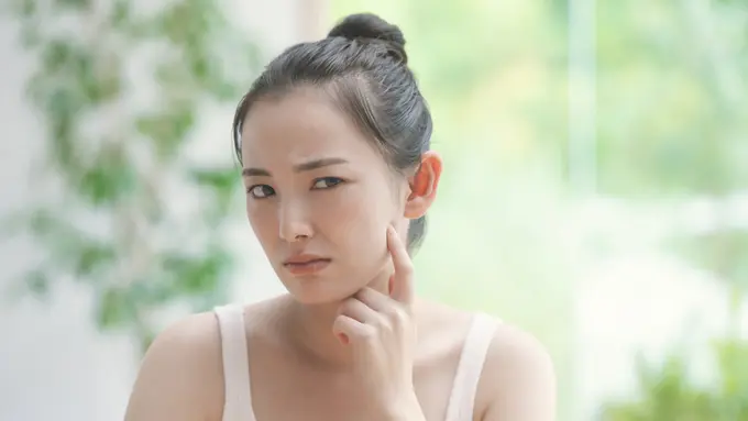 Jangan Lakukan 4 Hal Ini Jika Muka sedang Berjerawat, Akibatnya Bisa Fatal Lho