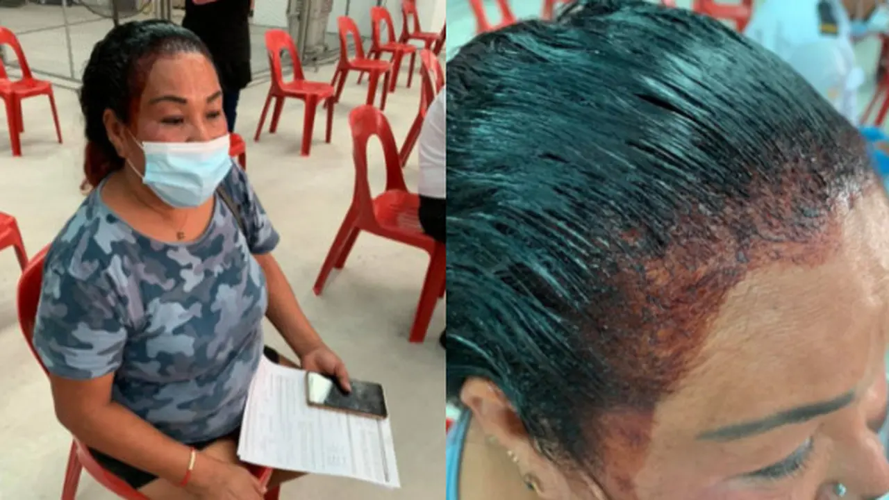Tak Ingin Ketinggalan Vaksin, Aksi Kocak Wanita Ini Antre saat Rambut Sedang Dicat