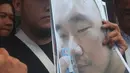 Pelapor penganiayaan, Ronny Yuniarto menunjukkan sebuah gambar usai membuat laporan di Polres Metro Jakarta Selatan, Kamis (21/6). Anggota Komisi III DPR Herman Hery diduga menganiaya Ronny Yuniarto bersama ajudannya. (Merdeka.com/Imam Buhori)
