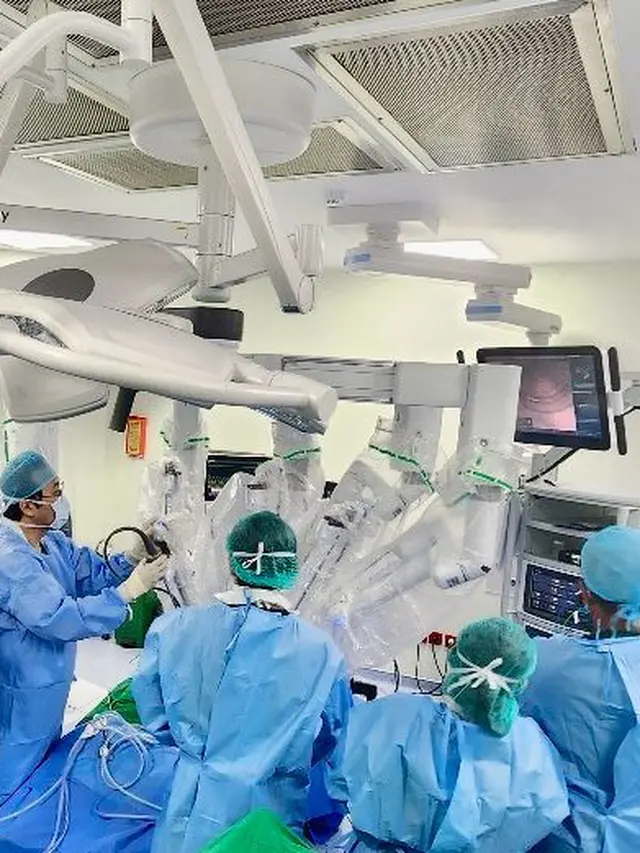 Operasi batu empedu pertama di Indonesia dengan robot Da Vinci Xi sukses dilakukan di Siloam Hospitals. Prosedur minim invasif ini tawarkan pemulihan cepat dan presisi tinggi. (Foto: Dokumen Pribadi Siloam Hospitals)
