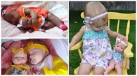 Potret Lucu Bayi Mirip Boneka