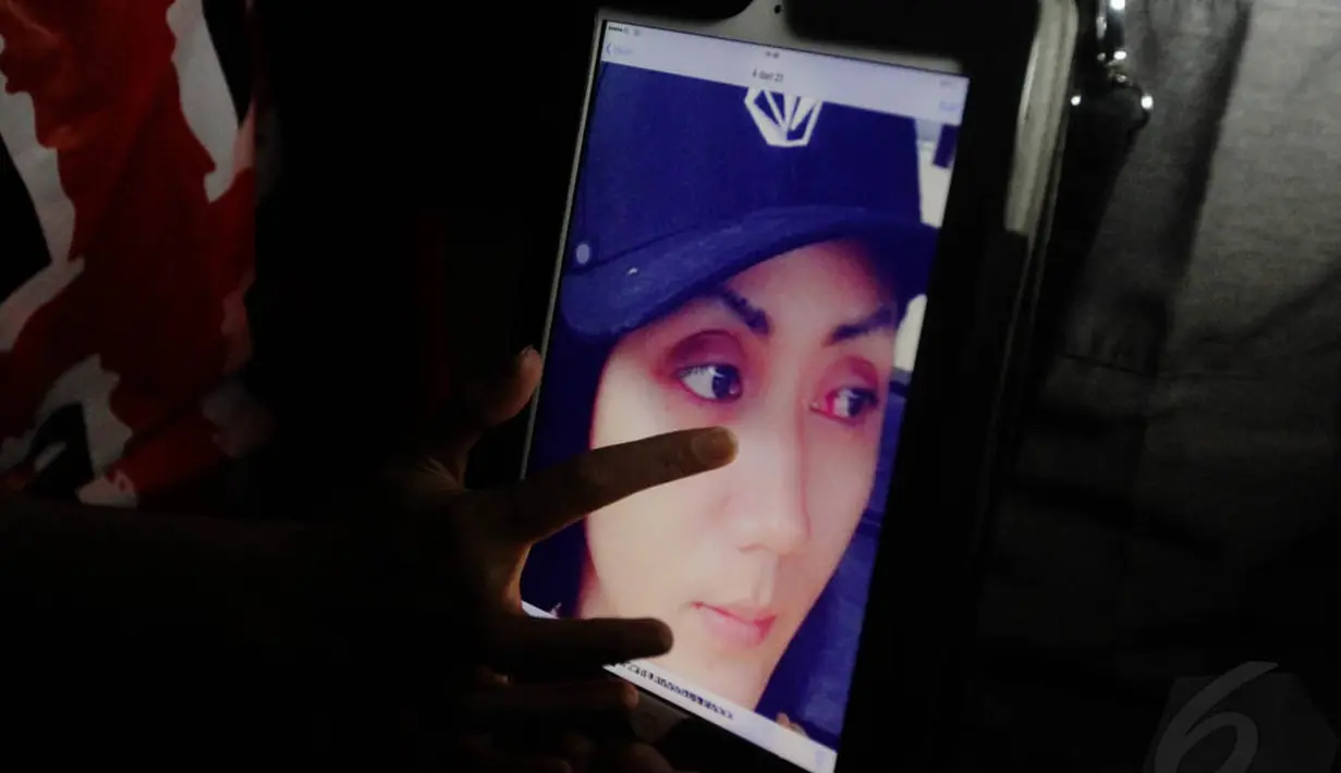 Melalui foto, Aida Saksia menunjukkan beberapa bagian tubuhnya yang memar akibat KDRT oleh sang suami Mahendra Pramudiya alias Rindra, Jakarta, Minggu (16/11/2014). (Liputan6.com/Faizal Fanani) 