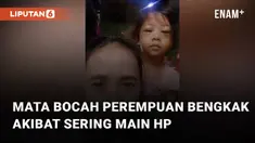Seorang ibu curhat saat kedua mata anaknya bengkak mengundang perhatian