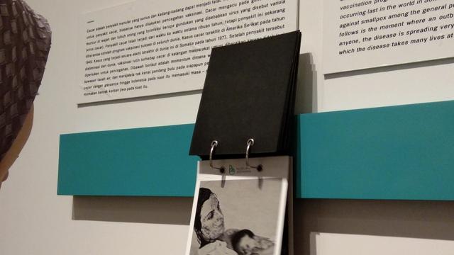 Sebuah foto menunjukkan ibu dan anak yang terkena cacar api sebelum ada vaksin, dipajang di museum Bio Farma (Liputan6.com/Giovani Dio Prasasti)