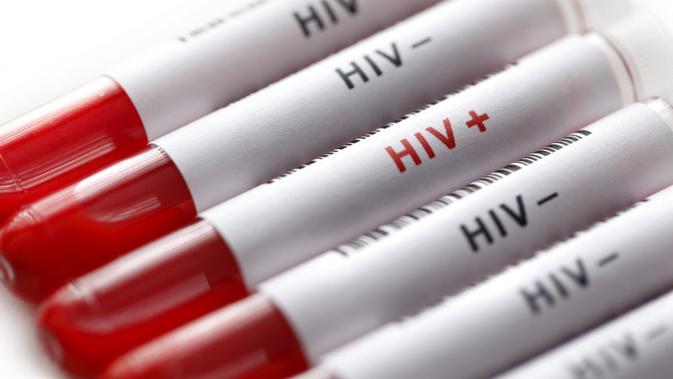 Meski sepele, kamu nggak boleh mengabaikan tanda seseorang terkena HIV ini ya. (Sumber Foto: POZ Magazine)