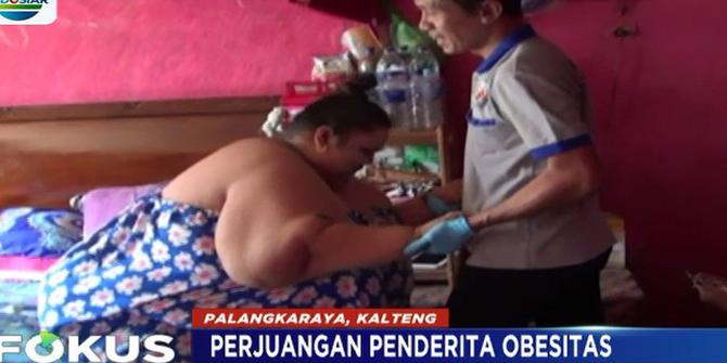 Titi Wati Penderita Obesitas di Palangkaraya Kini Sudah Bisa Berjalan