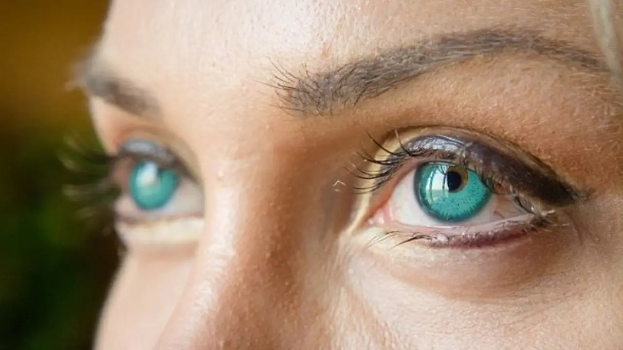 Demi Ubah Warna Iris Mata, Model Ini Jalani Operasi