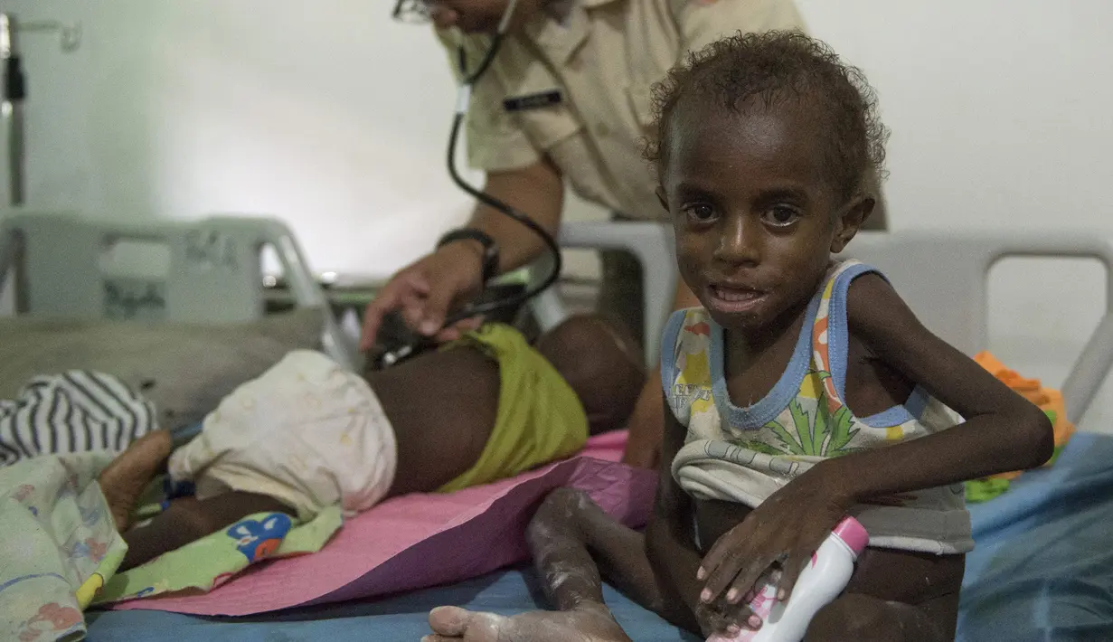 Seorang anak menjalani perawatan di rumah sakit setempat di Agats, Asmat, provinsi Papua Barat (26/1). Sebanyak 86 pasien anak gizi buruk dan campak di Kabupaten Asmat masih dirawat di Rumah Sakit Umum Daerah (RSUD) setempat. (AFP/Bay Ismoyo)