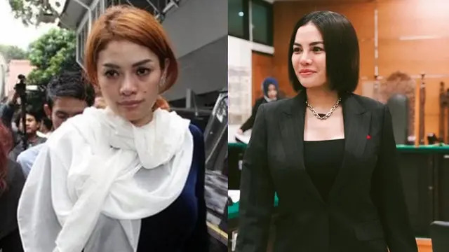 Beda Penampilan 9 Artis Sebelum vs Setelah Operasi Plastik, Bikin Pangling