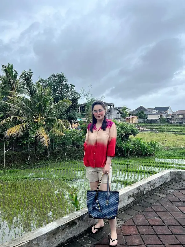 6 Potret Jennifer Dunn Usai Jalani Operasi Potong Lambung, Makin Langsing