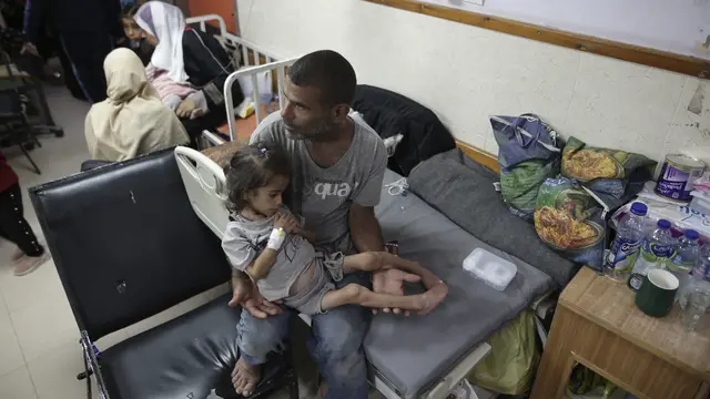 Anak-anak Palestina menderita malnutrisi