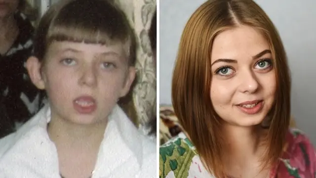 Before - After Adopsi