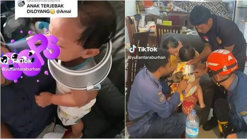 Viral, Kepala Anak Ini Nyangkut di Loyang Kue, Diselamatkan Damkar