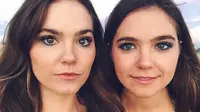 Sepasang saudara kembar identik, Nina dan Randa Nelson (22) mengungkap rahasia menyembuhkan jerawat membandel