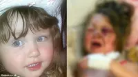 Tragis! Ditabrak Motor, Wajah Bayi Olivia Seperti `Chucky`
