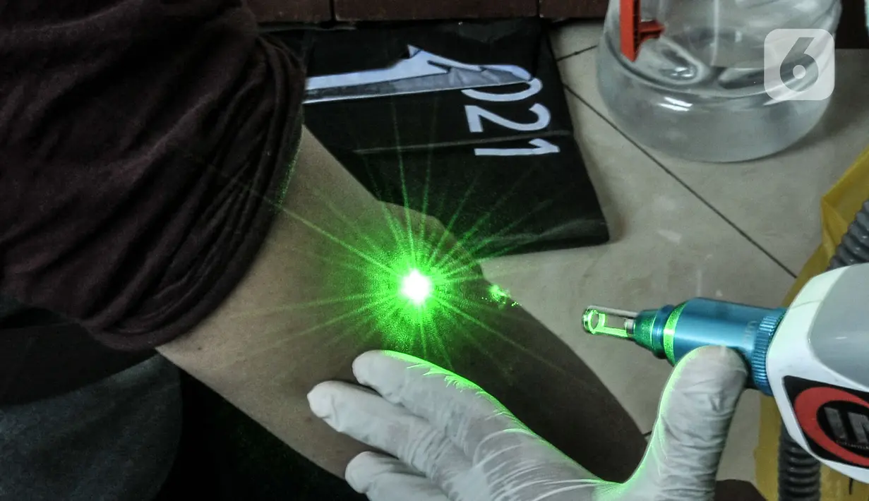 Peserta menjalani pengapusan tato dengan mesin laser di Masjid Baitul Muhyi, Jakarta Timur, Jakarta, Kamis (29/4/2021). Layanan ini diharapkan mampu membantu sekaligus mendukung mereka yang ingin mengubah kehidupan yang lebih baik. (merdeka.com/Iqbal S. Nugroho)