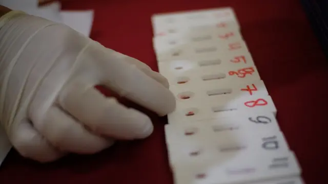 Siapkan Operasional di Era New Normal, ICM Adakan Rapid Test untuk Karyawannya