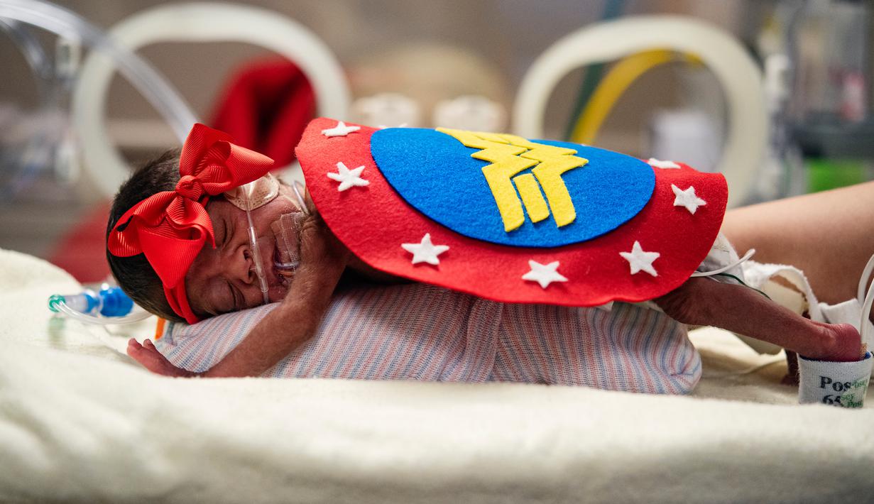 Infant Calixta Renteria mengenakan kostum Wonder Woman saat menjalani perawatan di bagian NICU sebuah rumah sakit di Texas, Rabu (30/10/2019). Pihak RS memakaikan kostum pada bayi-bayi prematur untuk merayakan Halloween pertama mereka. (Sarah A. Miller/Tyler Morning Telegraph via AP)