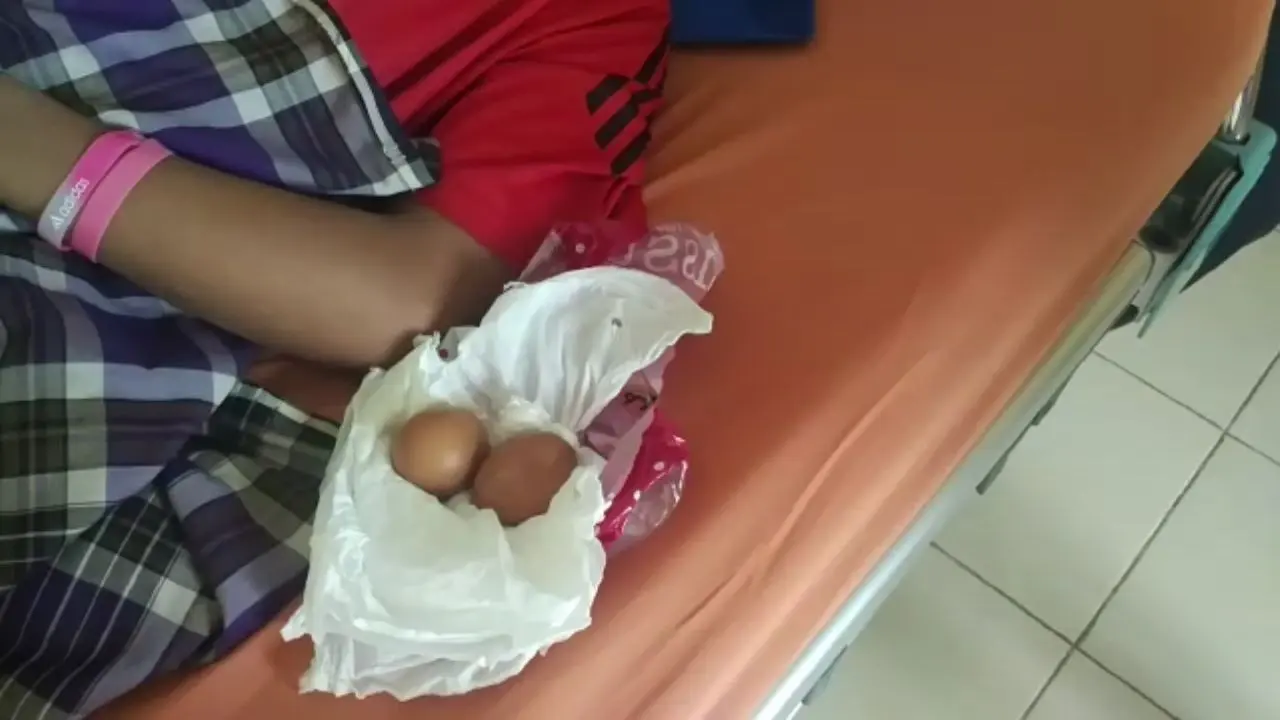 Temuan Penting Dokter Soal Fenomena Remaja Bertelur Ayam