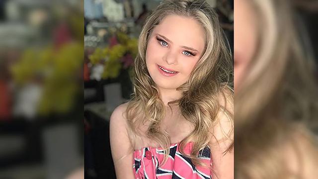 Remaja Ini Buktikan Penderita Down Syndrome Juga Bisa Jadi Model