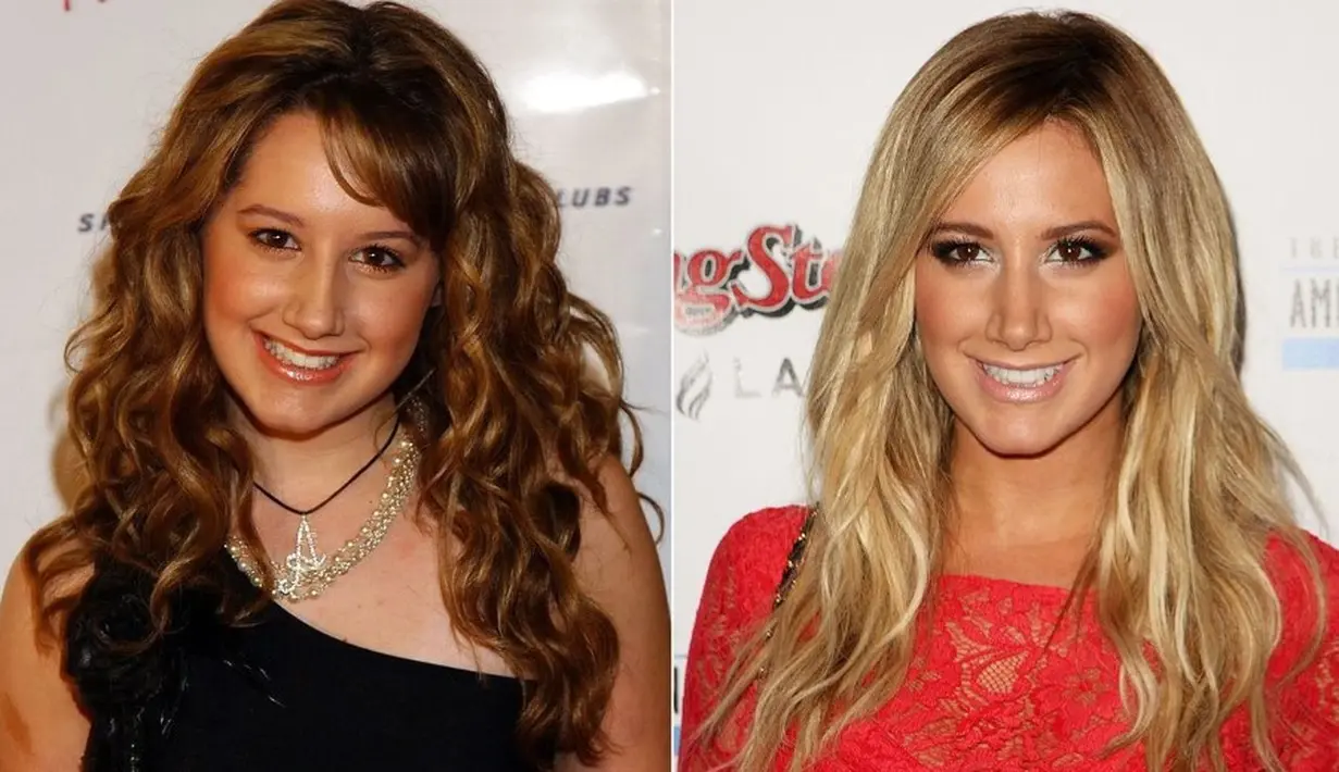 Ashley Tisdale pun dengan terang-terangan melakukan operasi hidung karena ia kesulitan bernapas. (Celebrity plastic surgery online)
