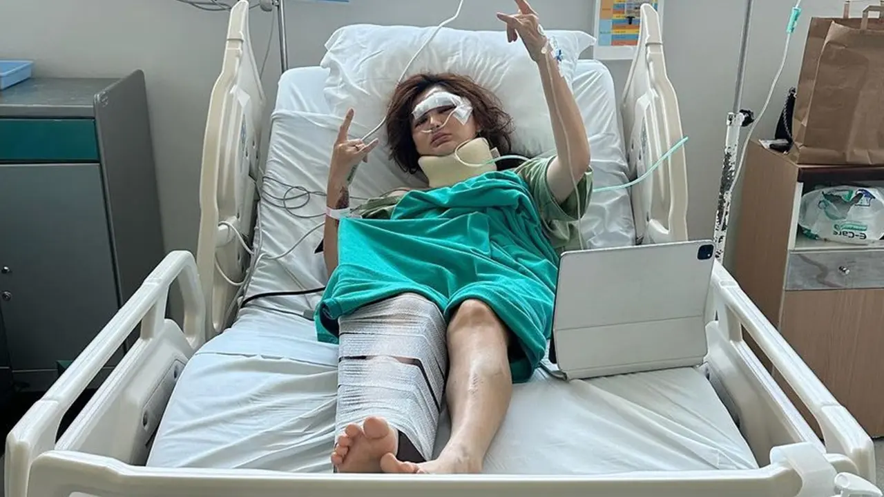 6 Potret Kondisi Angela Lee Pasca Alami Kecelakaan Mobil di Tol, Kaki Dipasang Pen