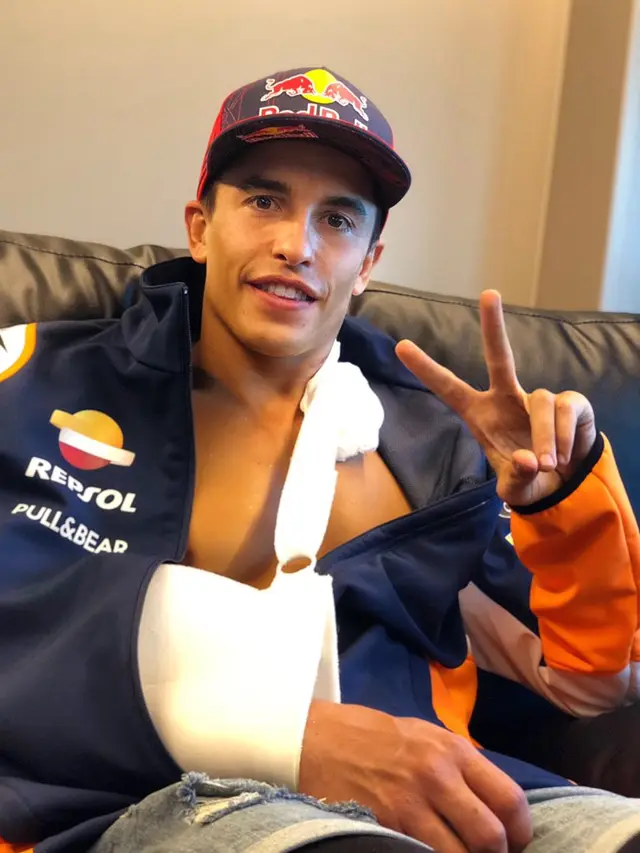 Dokter Ungkap Peluang Marc Marquez Tampil di MotoGP Rep Ceko