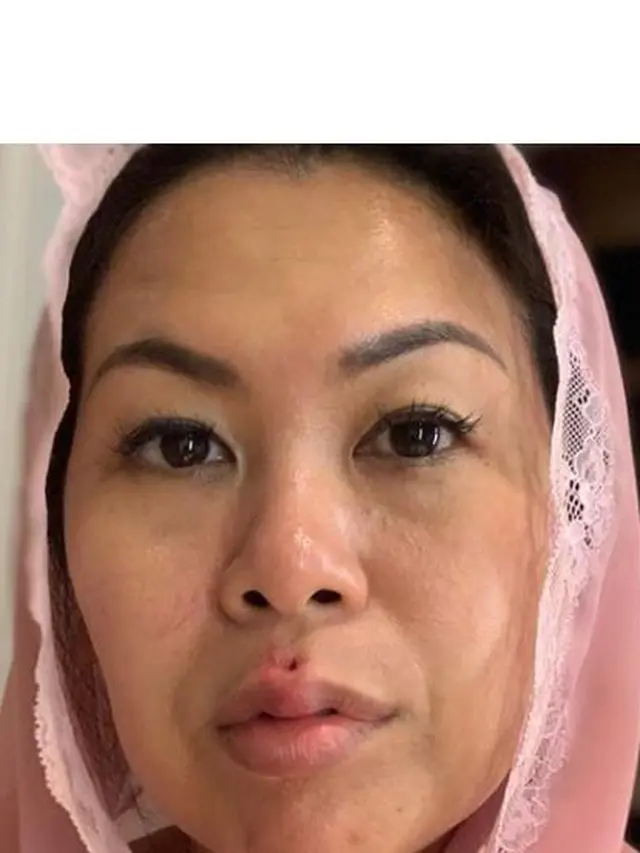 Yenny Wahid Pamer Bibir Jontor Gara-Gara Naik Skuter Listrik di Oslo