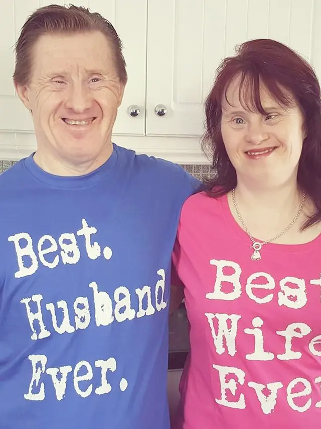 [Bintang] Down Syndrome