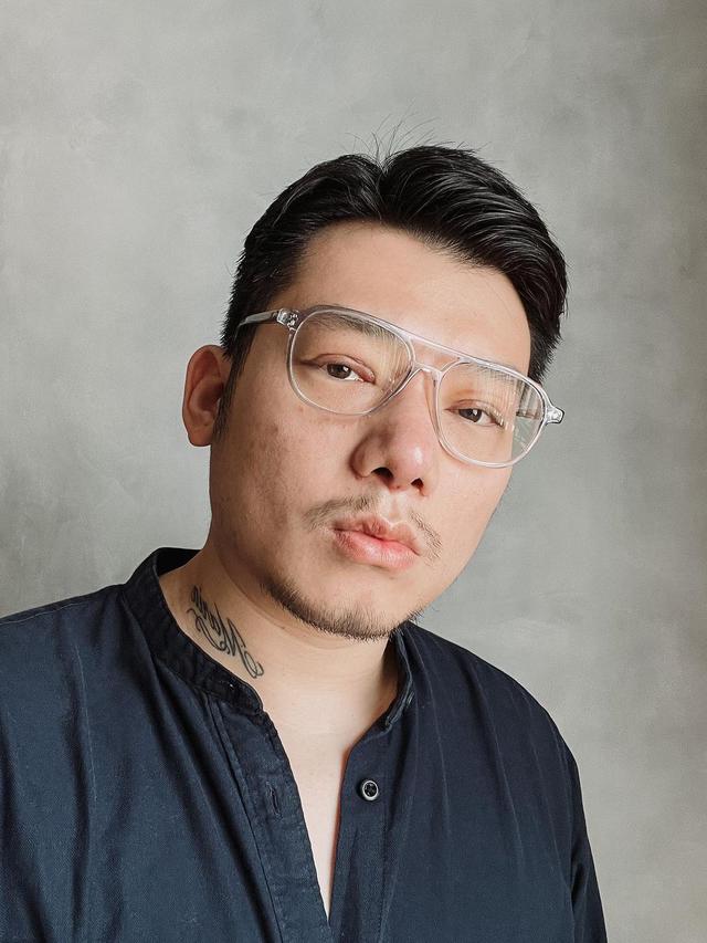 7 Potret Chef William Gozali Jalani Operasi Plastik, Perubahannya Bikin Pangling