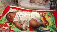 Seorang bayi laki-laki lahir dengan berat mencapai 5 kilogram di Rajasthan, India.