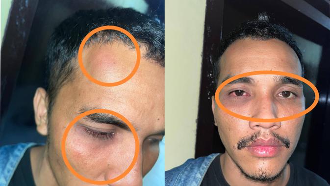 Pria di Kendari Disekap dan Disiksa dalam Arena Biliar Diduga Milik Perwira Polisi