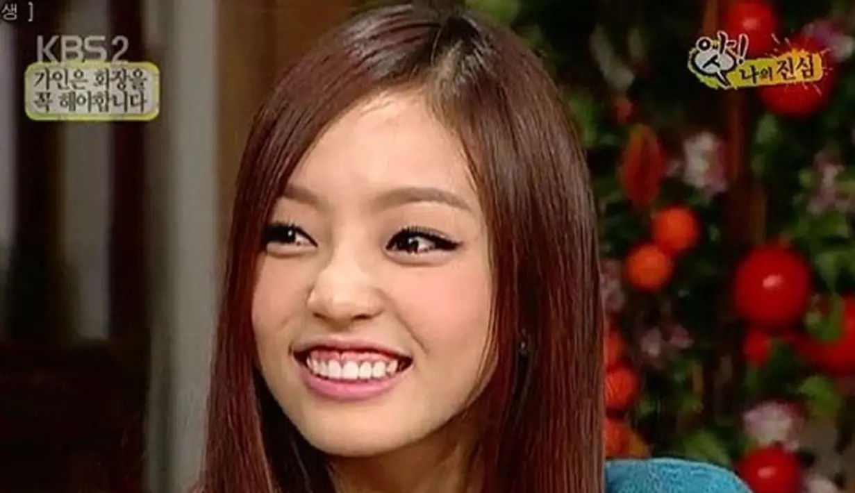 Goo Hara mengaku jika 'gummy smile' membuat dirinya tidak nyaman. (Foto: koreaboo.com)