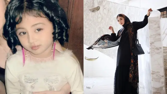 Aktris Berambut Keriting Jadi Lurus