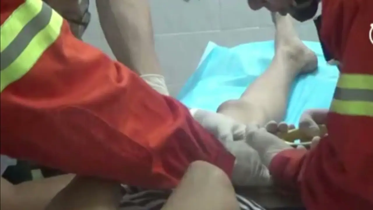 Cincin Tersangkut di Penis, Remaja China Dibawa ke Rumah Sakit