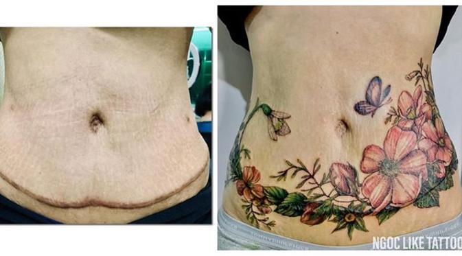 7 Potret Tato Keren Sulap Bekas Luka Jadi Seni Indah Citizen6 Liputan6 Com