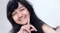 Kecelakaan, Jihan Audy Banjir Dukungan dan Doa