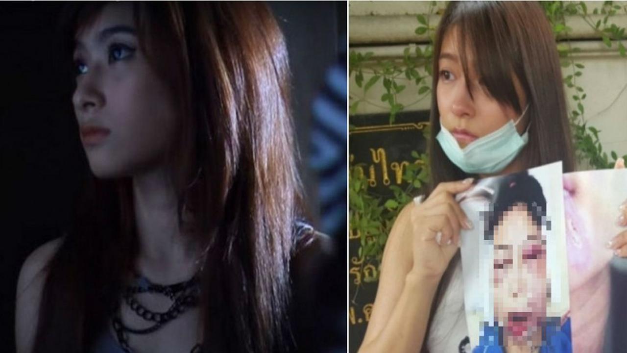 Ingin Cantik, Wajah Model Ini Malah Hancur Habis Operasi Plastik