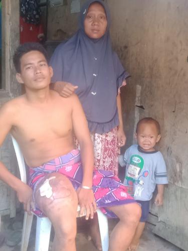Sarip (37) Penderita Kanker Tulang Bersama Keluarganya. (Dokumentasi Ketua RT). (Kamis, 19/05/2022).