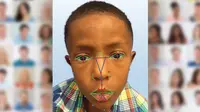 Teknologi pemindaian wajah untuk mendeteksi penyakit langka. (Foto: Istimewa)