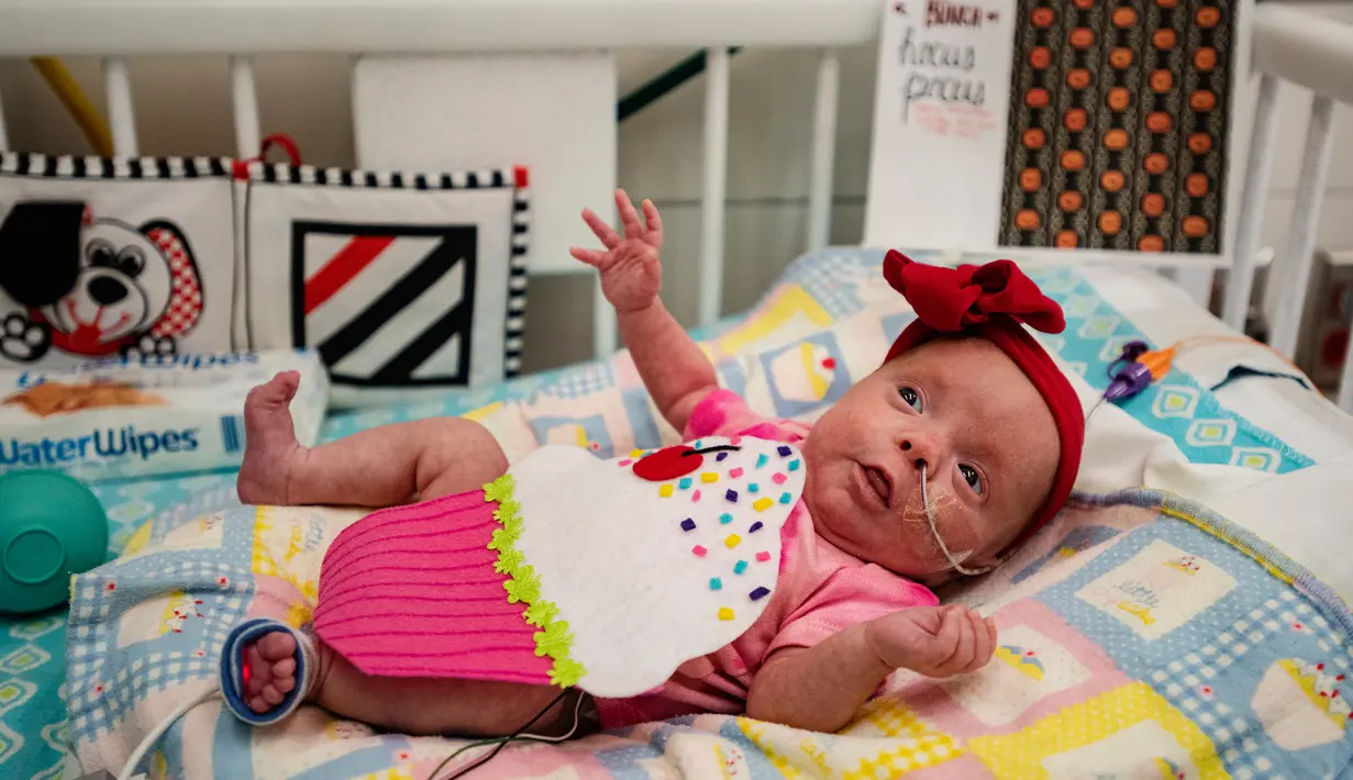Charlotte Brewer, Athena yang berusia dua bulan mengenakan kostum cupcake saat menjalani perawatan di NICU sebuah rumah sakit di Texas, Rabu (30/10/2019). Pihak RS memakaikan kostum pada bayi-bayi prematur untuk merayakan Halloween pertama mereka. (Sarah A. Miller/Tyler Morning Telegraph via AP)